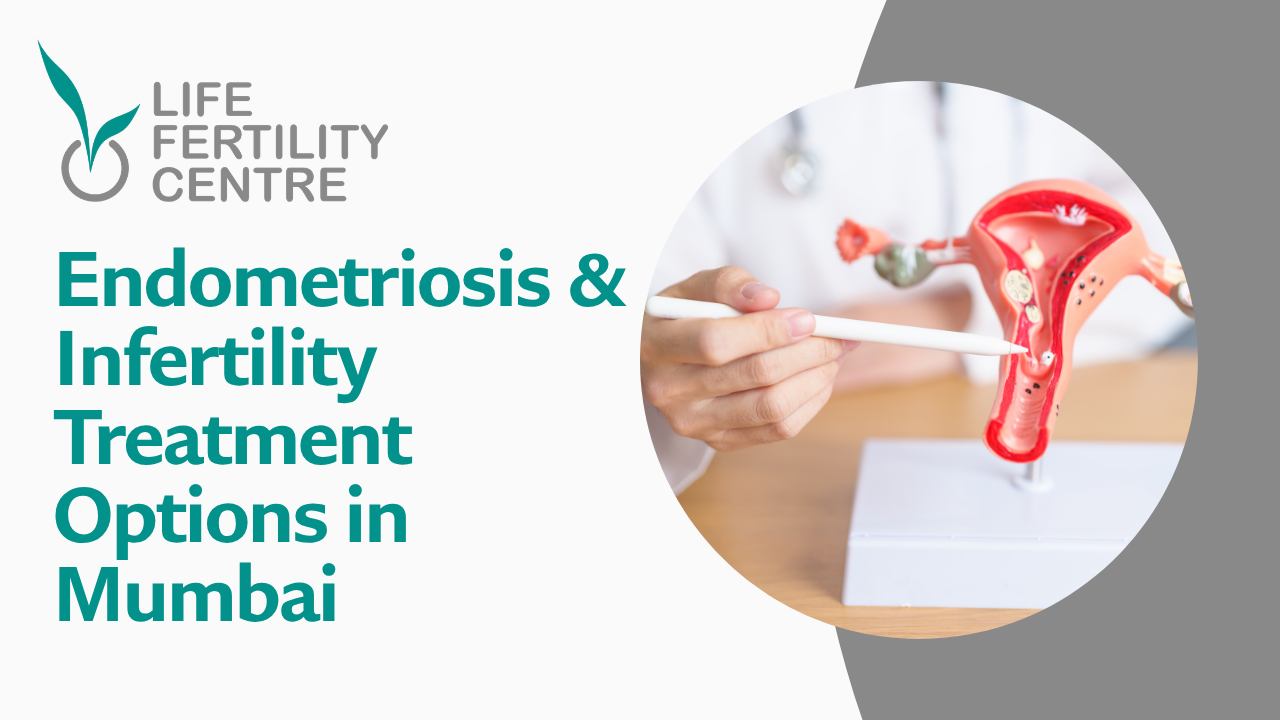 Endometriosis & Infertility Treatment Options in Mumbai | Life Fertility Center
